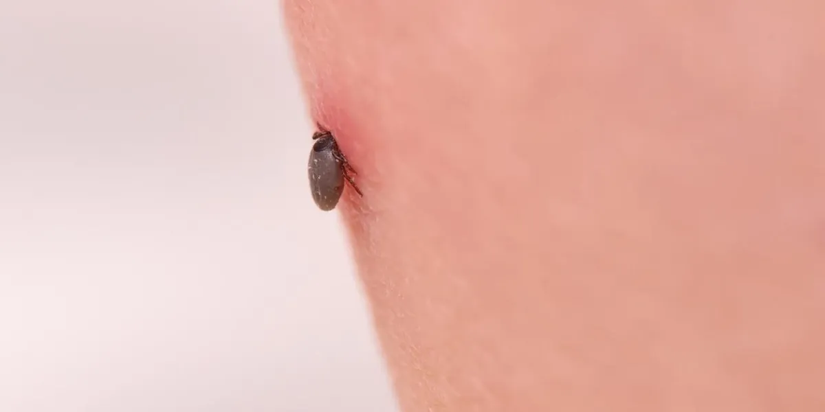 the tick bites the person, sucked deep under the skin