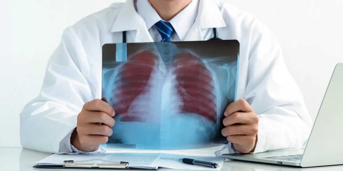 doctor examining the patient chest x-ray film lungs scan in hospital lung problem lung cancer or pneumonia concept copy space