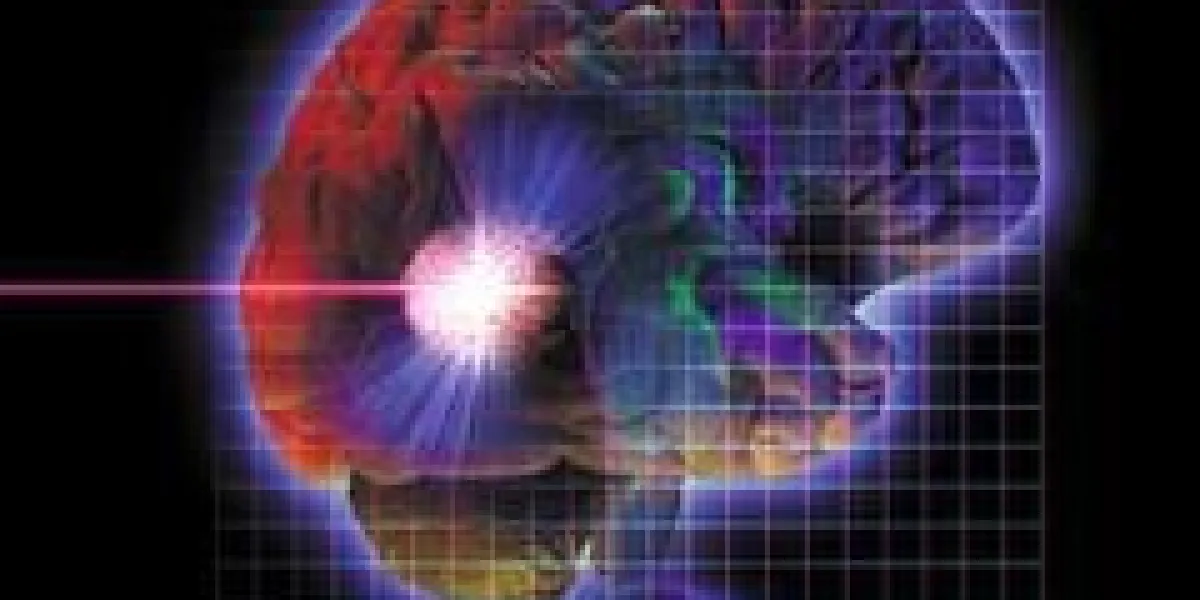 photo montage montrant une tumeur cérébrale en train d'être vaporisée par radiochirurgie