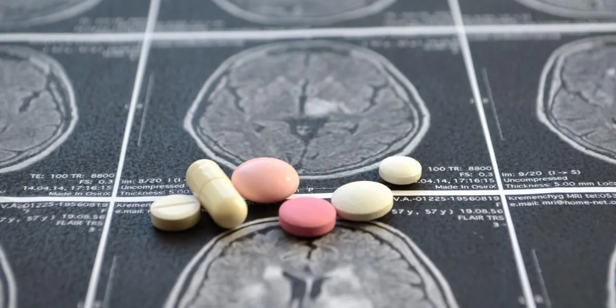 снимок инсульт кровоизлияние в мозг