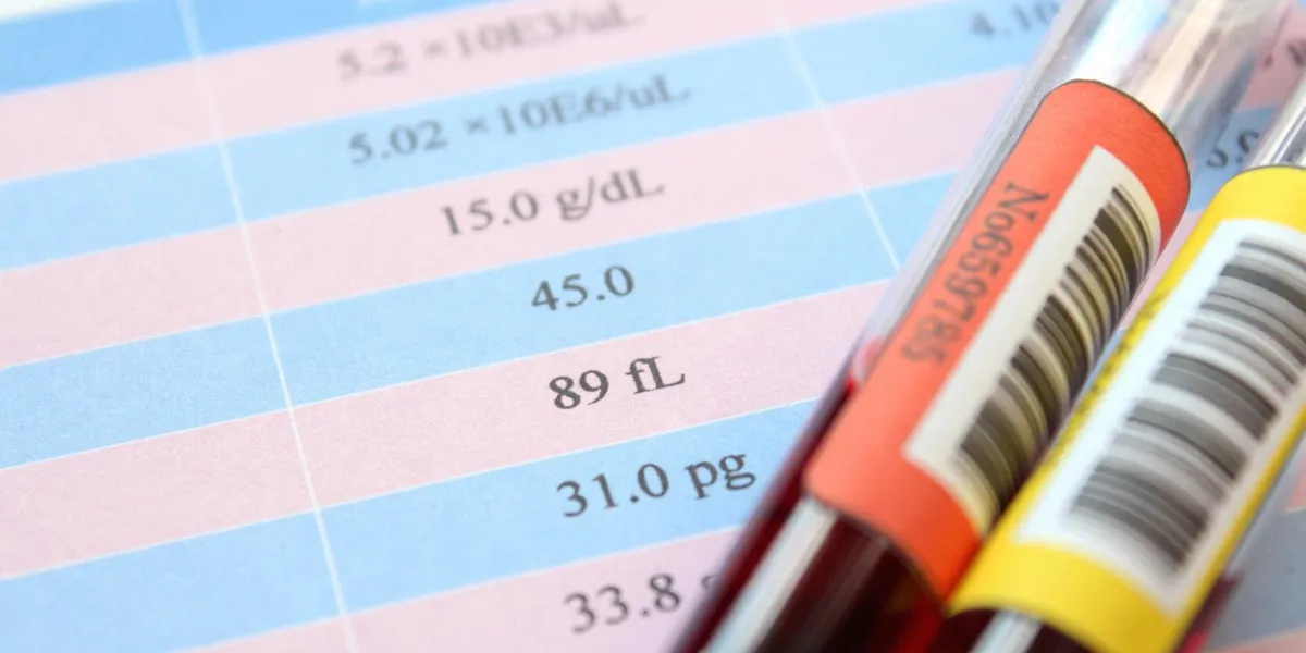 échantillon d'échantillon de sang de collection de sang