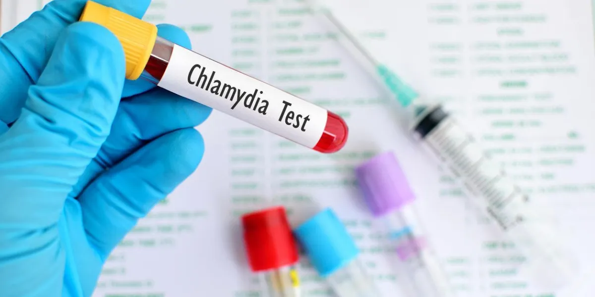 échantillon de sang pour test de chlamydia trachomatis (bactéries)
