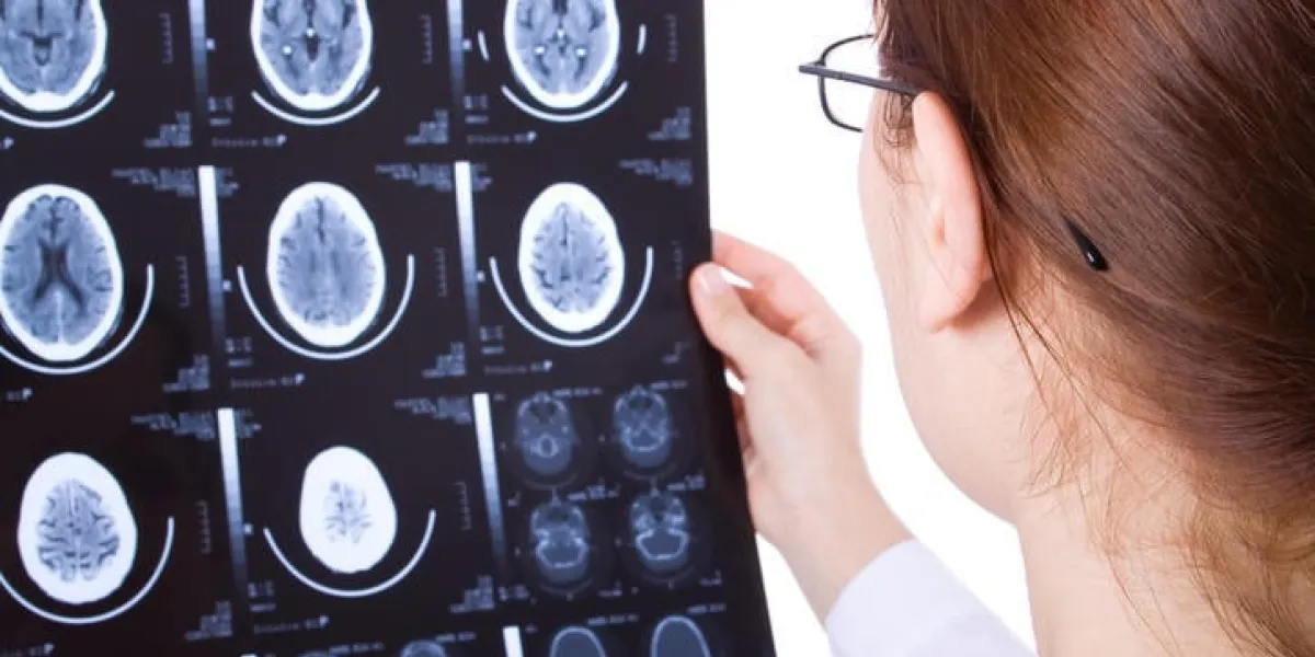 femme médecin examinant un scanner de cerveau