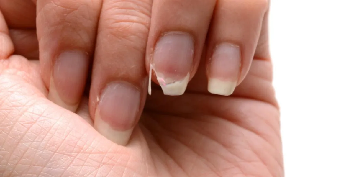 ongle cassé - main féminine