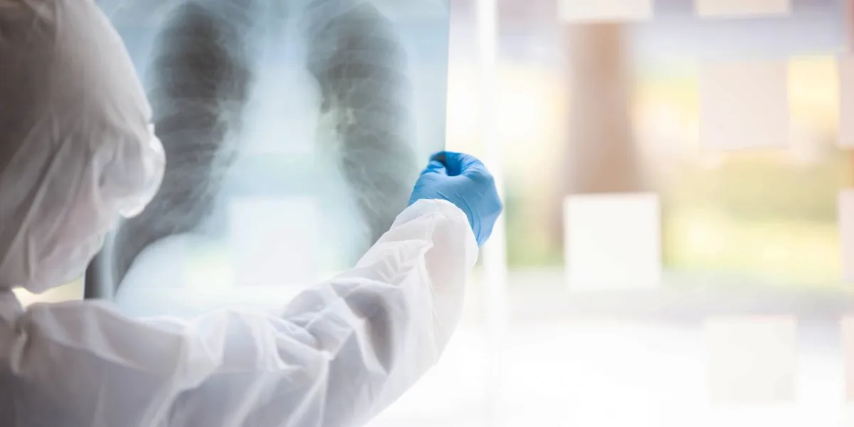 the doctor is testing a sample of biological tubes contaminated by corona-virus covid 19 and searching for a vaccine against the virus in the laboratory and film samples of infected lung