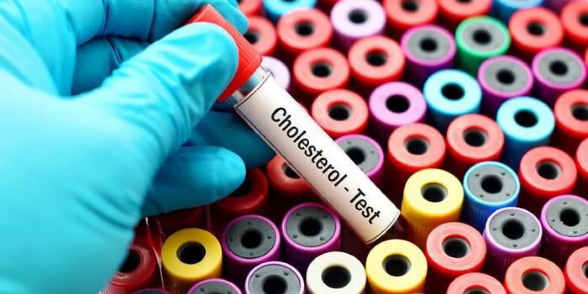 test de cholestérol