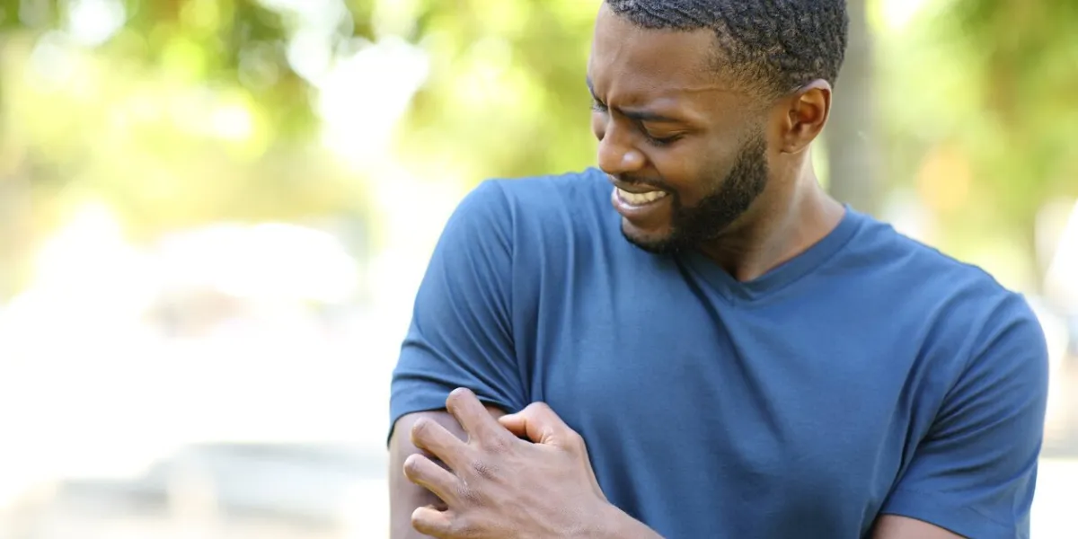 black man scratching itchy arm in a park