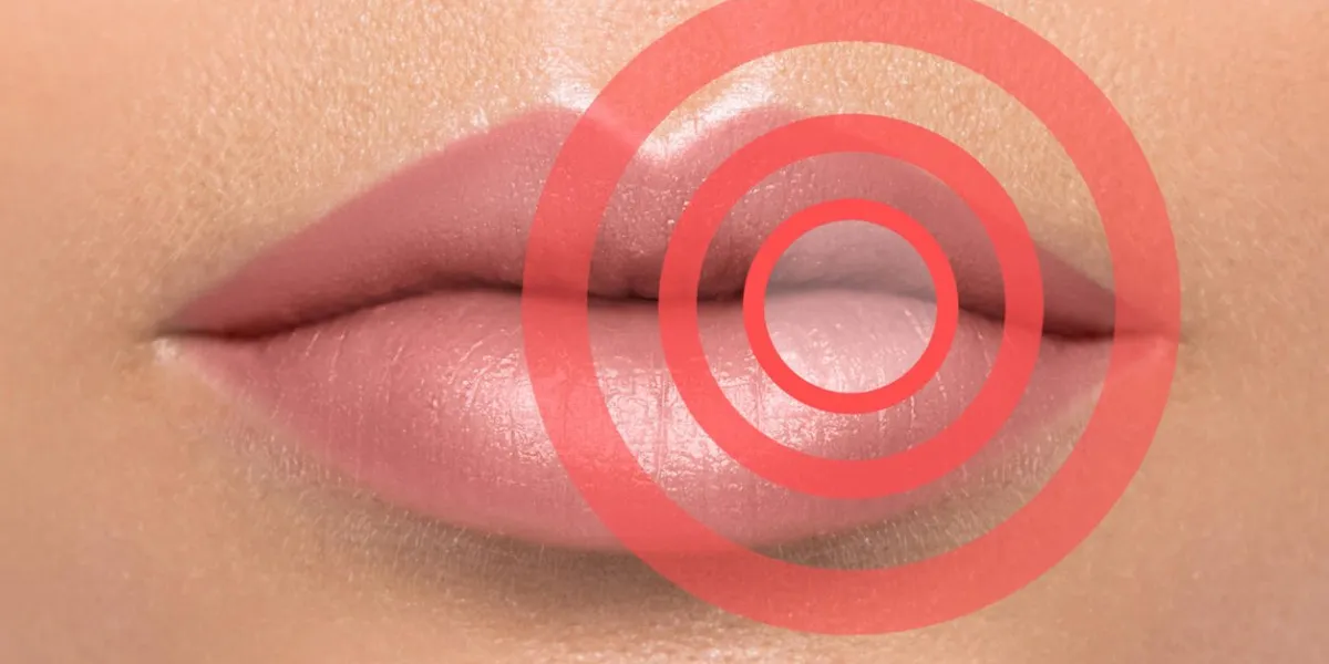 female lips with red circles affected or problem area healthcare or beauty concept