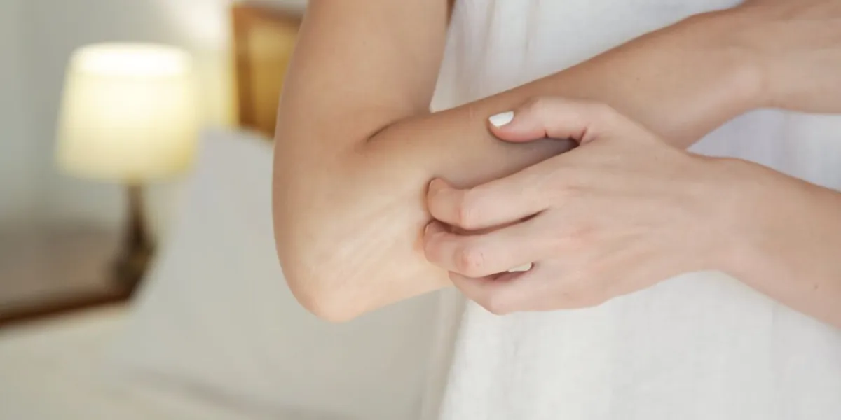 winterizing dry itchy skin on the elbow area