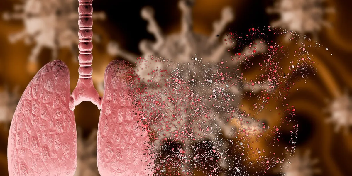 coronavirus attacking lung with severe pneumonia disintegrating it, leading to death 3d rendering