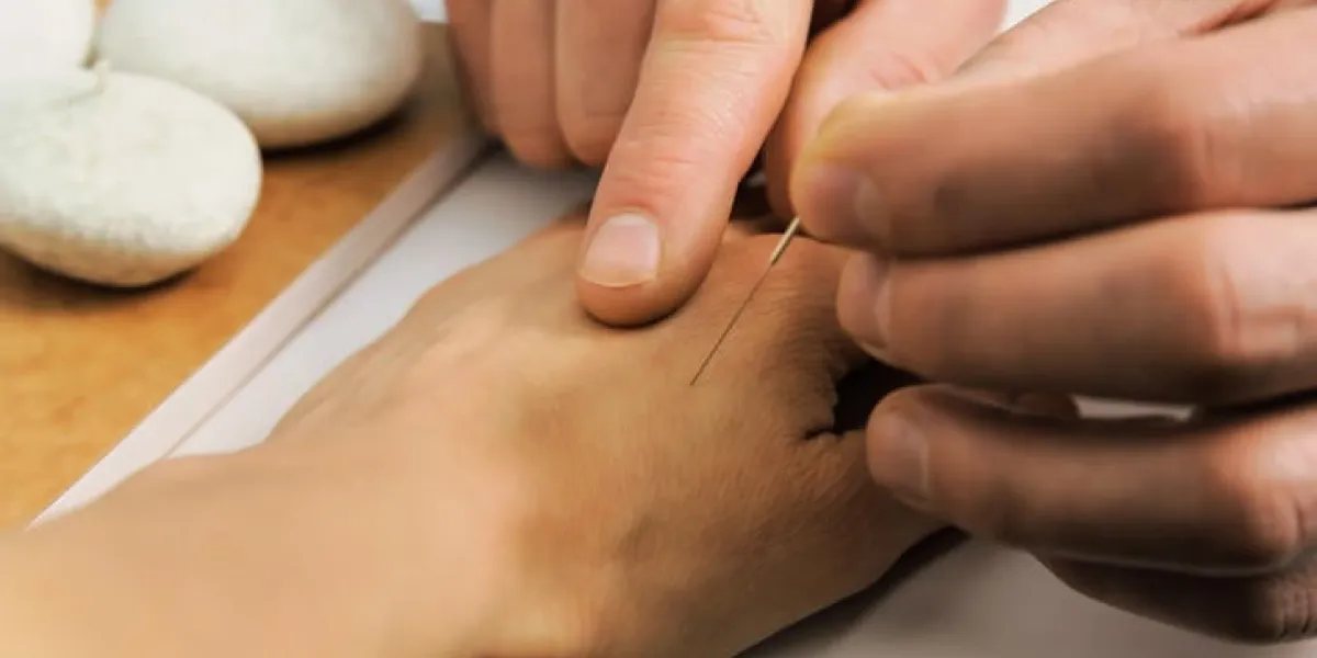 acupuncture médecine chinoise le thérapeute introduit aiguille au bon endroit sur la main