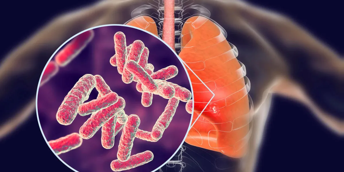 bacteria pneumonia, medical concept, 3d illustration showing human lungs and close-up view of rod-shaped bacteria in lungs