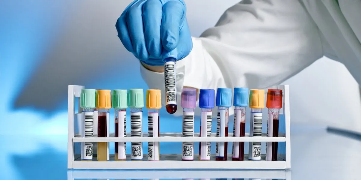 hand of a doctor taking a blood sample tube