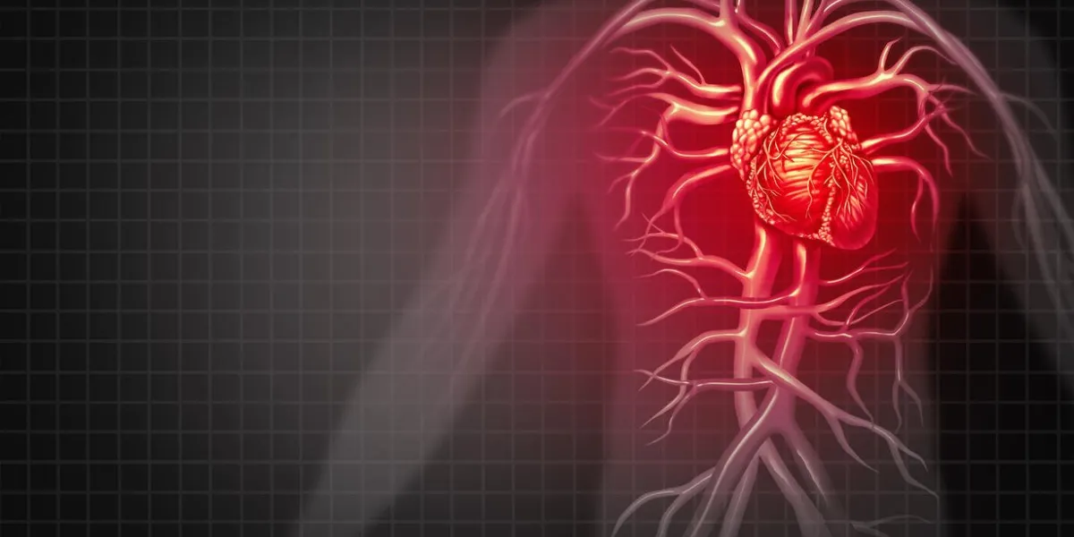 crise cardiaque et douleur thoracique maladie cardiovasculaire médicale comme une maladie d'un organe de circulation humaine dans un style d'illustration 3d