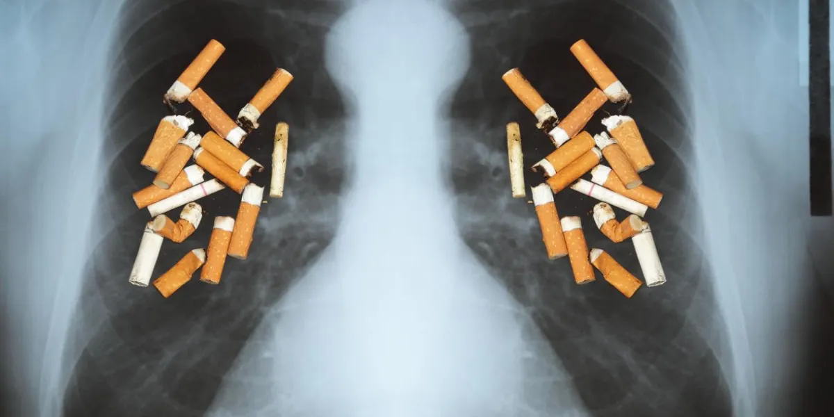 effets de la cigarette - cancer du poumon