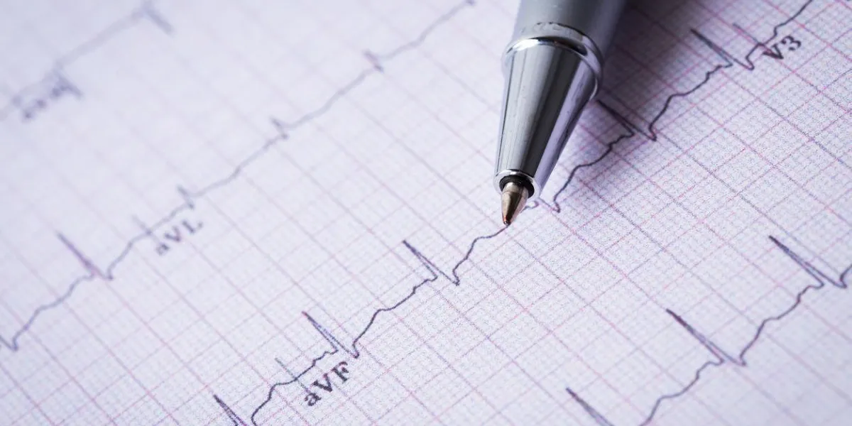 cardiogramme et stylo technique bouchent