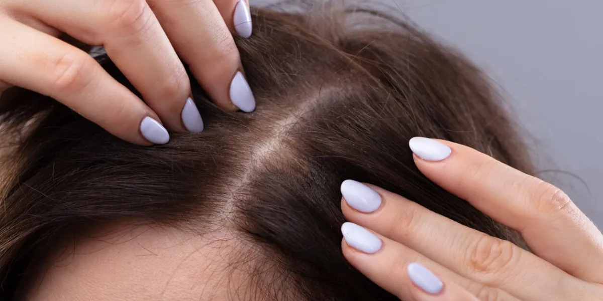 close-up of woman with thinning hair on head