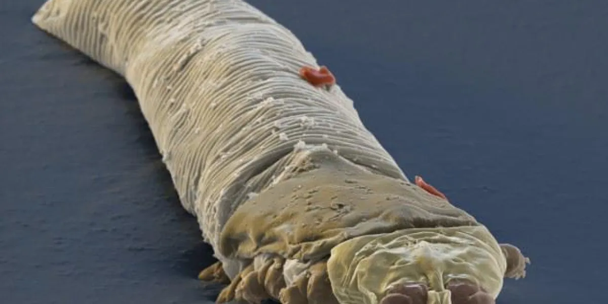 demodexc0025649-acarien des cils, sem-spljpg