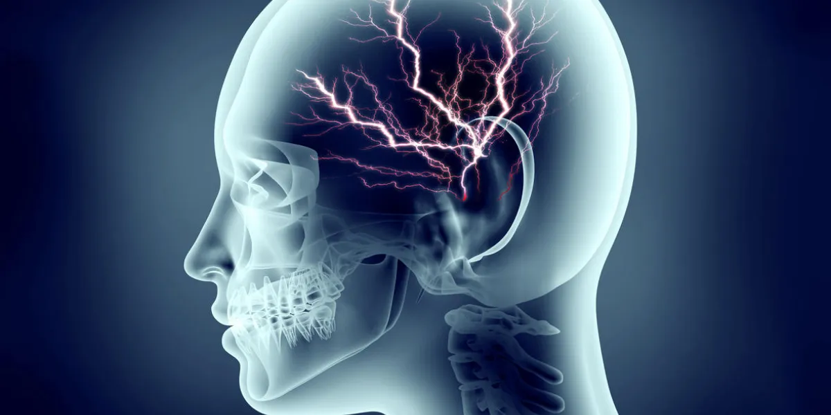 x-ray image of human head with lightning