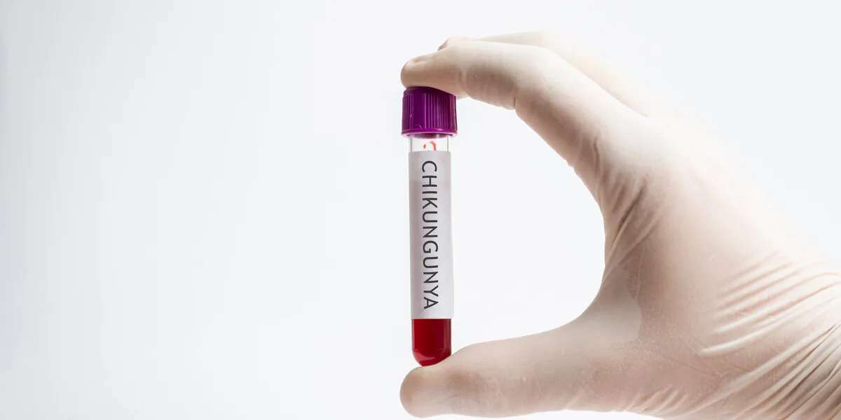 hand of laboratory assistant holding test tube with blood sample on white background chikungunya