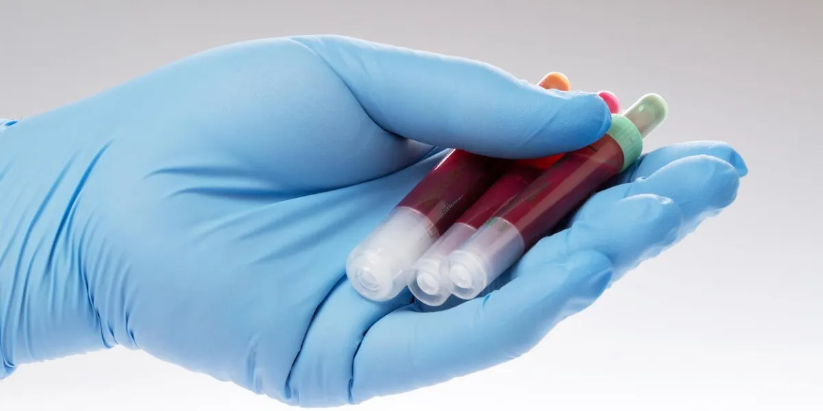 des échantillons de sang sont sur un formulaire de laboratoire pour trouver les valeurs de sang