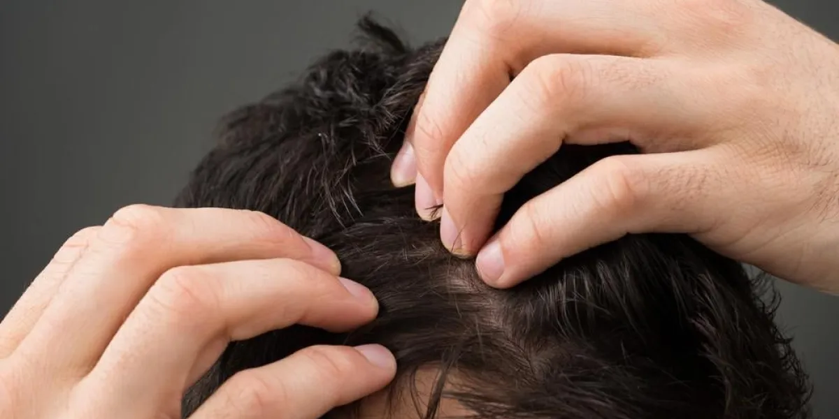 image recadrée de l'homme souffrant de perte de cheveux sur fond gris