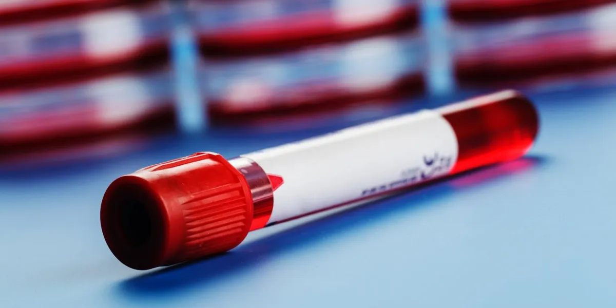 blood sample in a tube on a blue table
