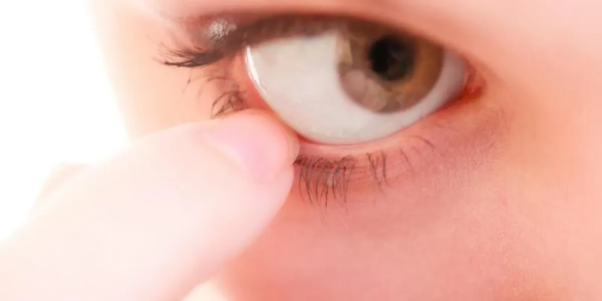 partie du visage yeux féminins médecine soins de santé des yeux humain corps étranger