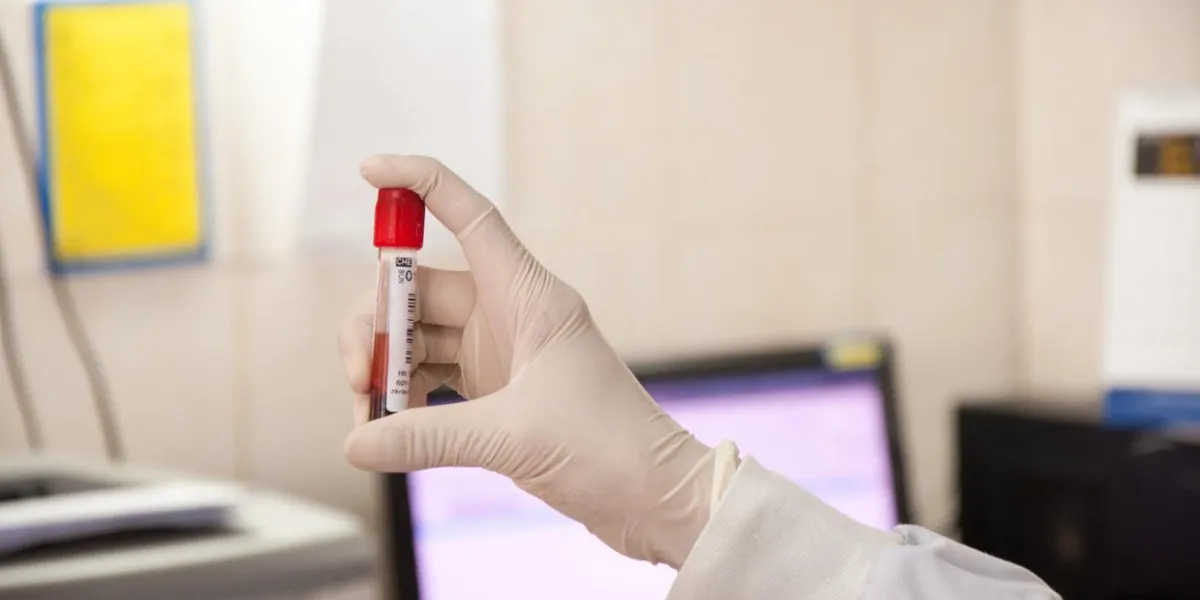 hand holding test tube with blood plasma ready for testing