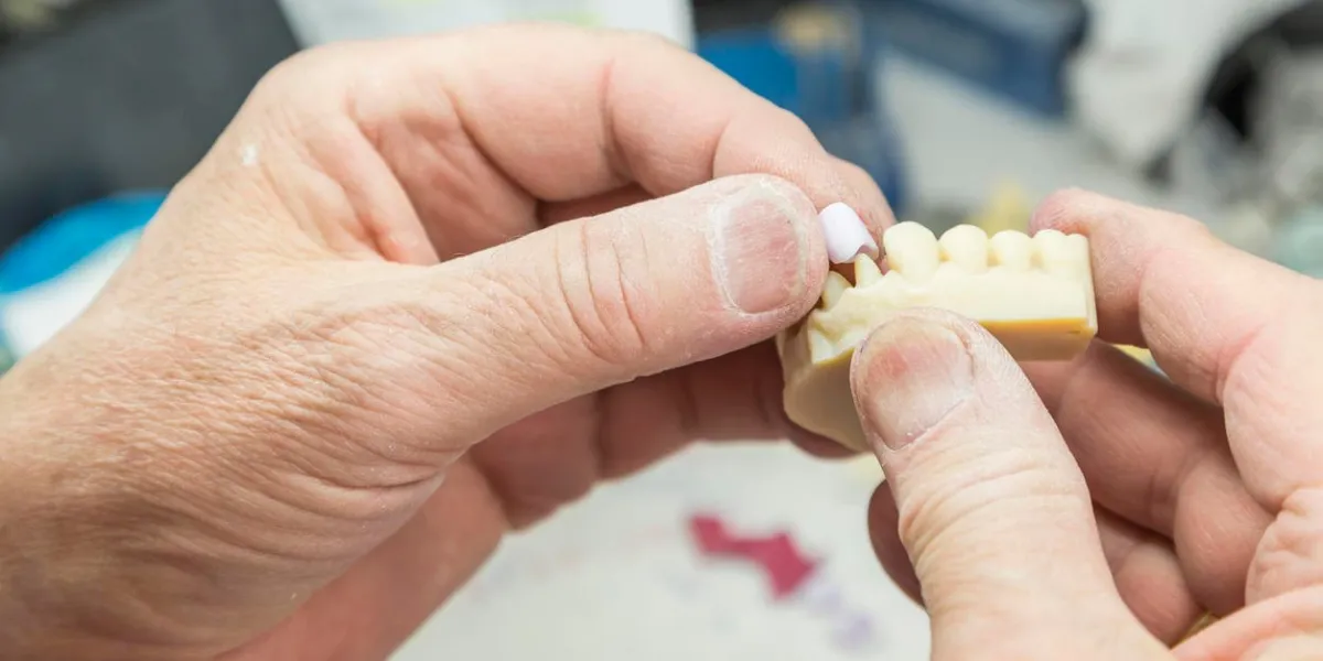 male dental technician working on a 3d printed mold for tooth implants in the lab