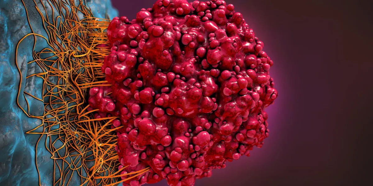 3d illustration of a brain cancer cell