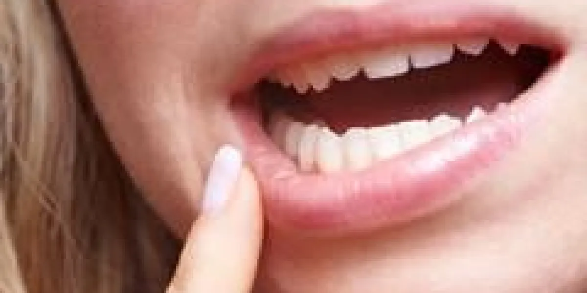 femme, douleur, gencives, tenue, doigt, elle, bouche