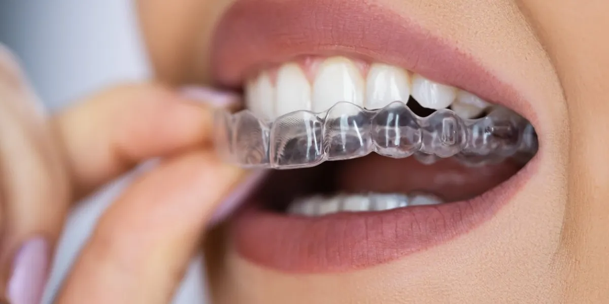 clear aligner dental night guard for teeth