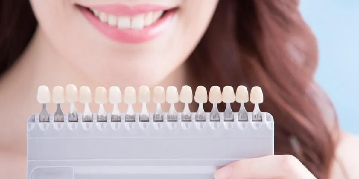 belle jeune femme avec des dents de santé et de tenir outil de blanchiment des dents isolé sur fond bleu, beauté asiatique