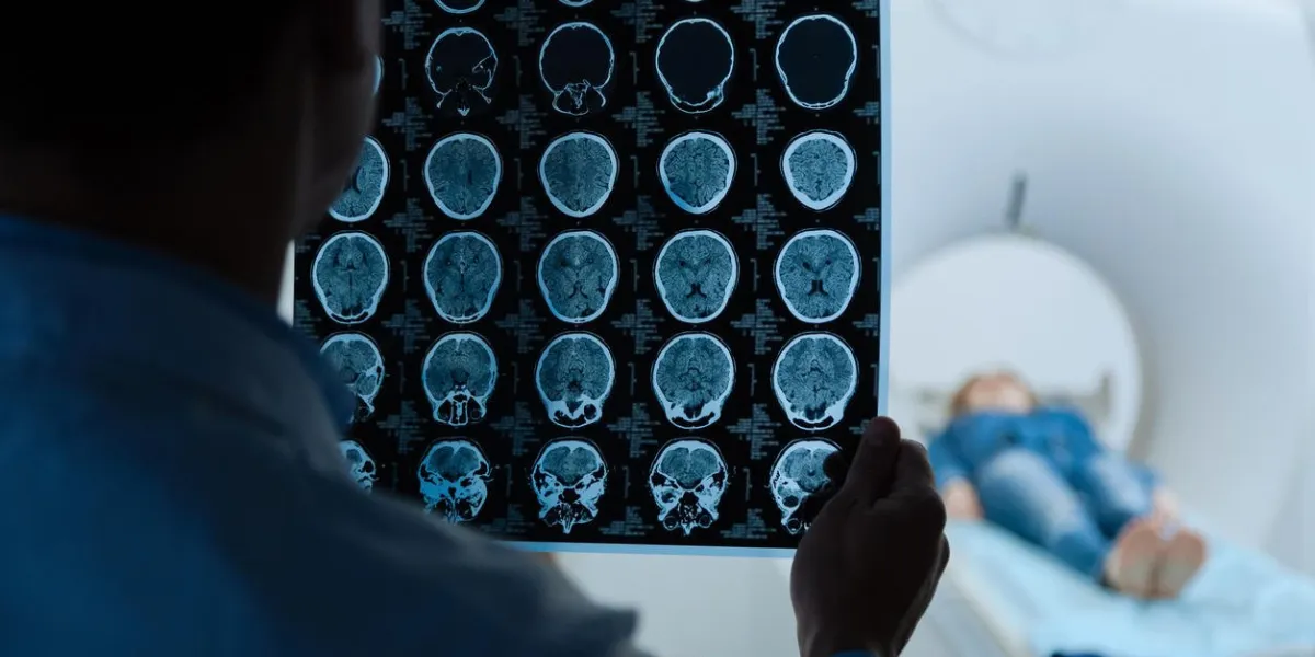 la pathologie du cerveau gros plan des images irm en cours d'examen par un homme médecin professionnel tout en faisant une recherche médicale