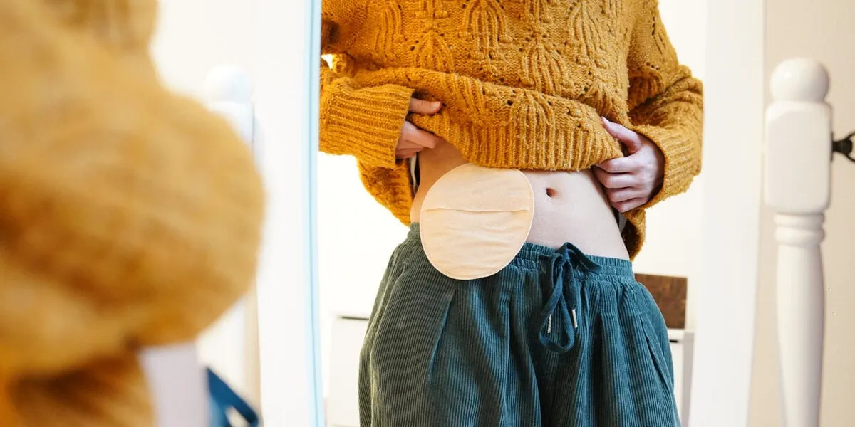 unrecognizable young woman looking at her ostomy bag in the mirror ostomized with a colostomy