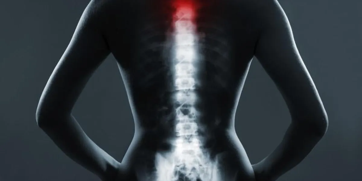 colonne vertébrale humaine en rayons x, sur fond gris la colonne vertébrale du cou est mis en évidence par la couleur rouge