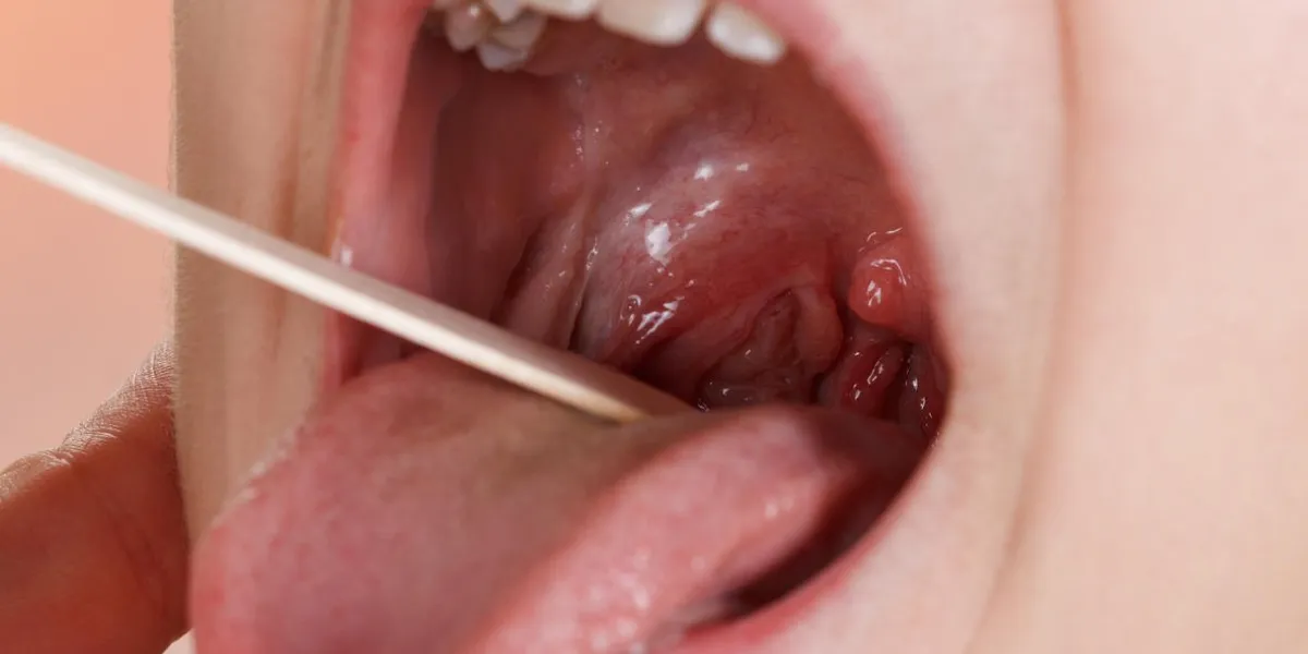 enfant avec un garçon médecin dans le bureau d'un pédiatre, un examen médical du pharynx et des amygdales