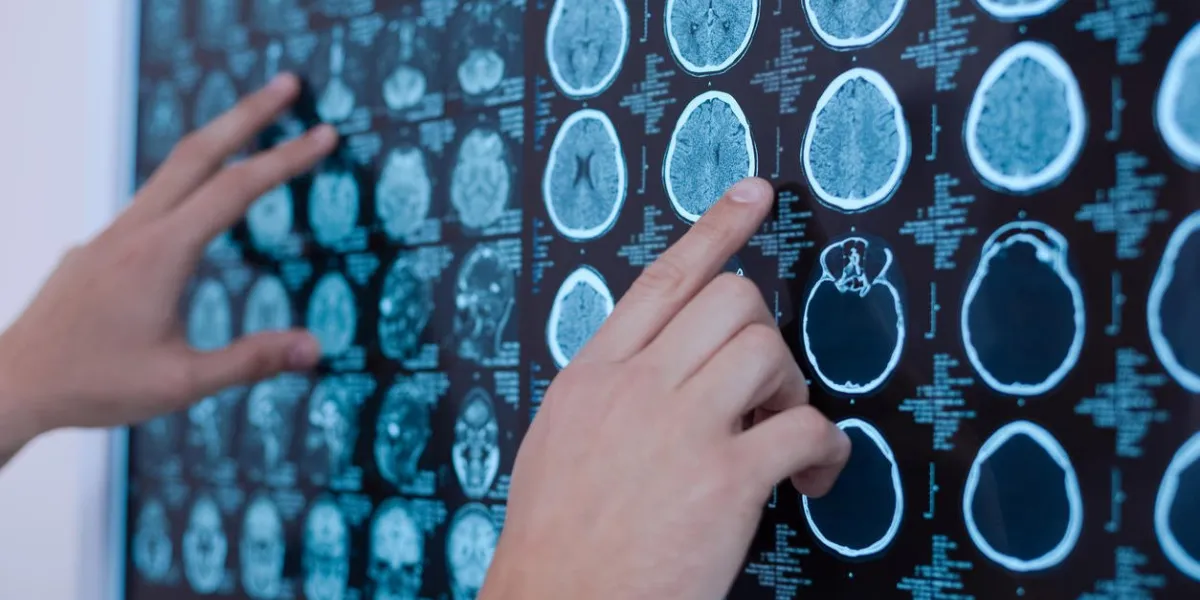 médecine professionnelle fermer des images de rayons x du cerveau humain mis sur le tableau blanc par un bon oncologue professionnel