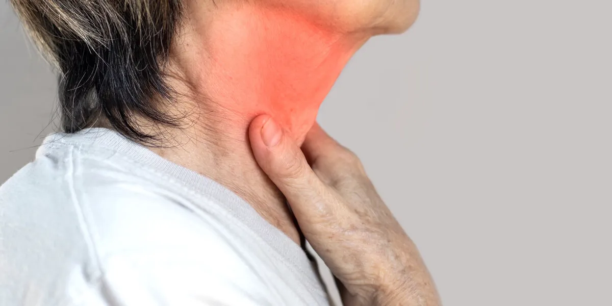 redness at the neck of asian, myanmar woman concept of sore throat, pharyngitis, laryngitis, esophagitis, thyroiditis, or dysphagia