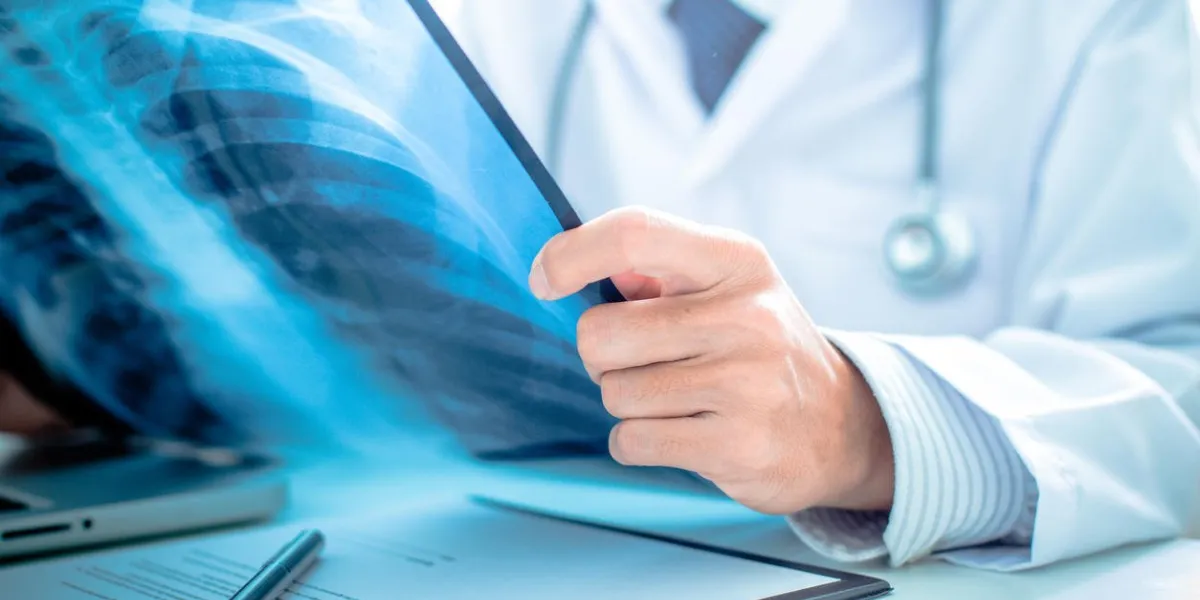 gros plan, de, mâle, docteur, tenue, rayons x, ou, roentgen, image