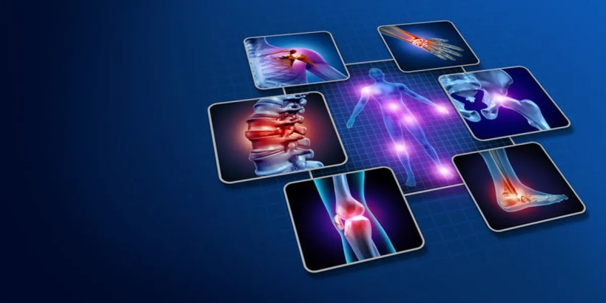 body joint pain concept as human skeleton and muscle anatomy of the body with a group of sore joints as a painful injury or arthritis illness symbol for health care and medical symptoms with 3d illustration elements