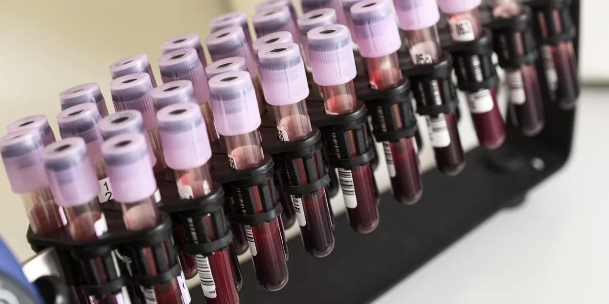 tube blood sample in a medical examination medical research
