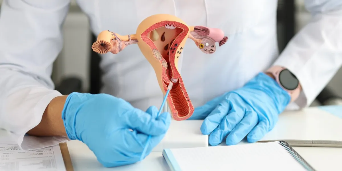 gynecologist holds model of female reproductive system and cytological brush study of female reproductive system concept