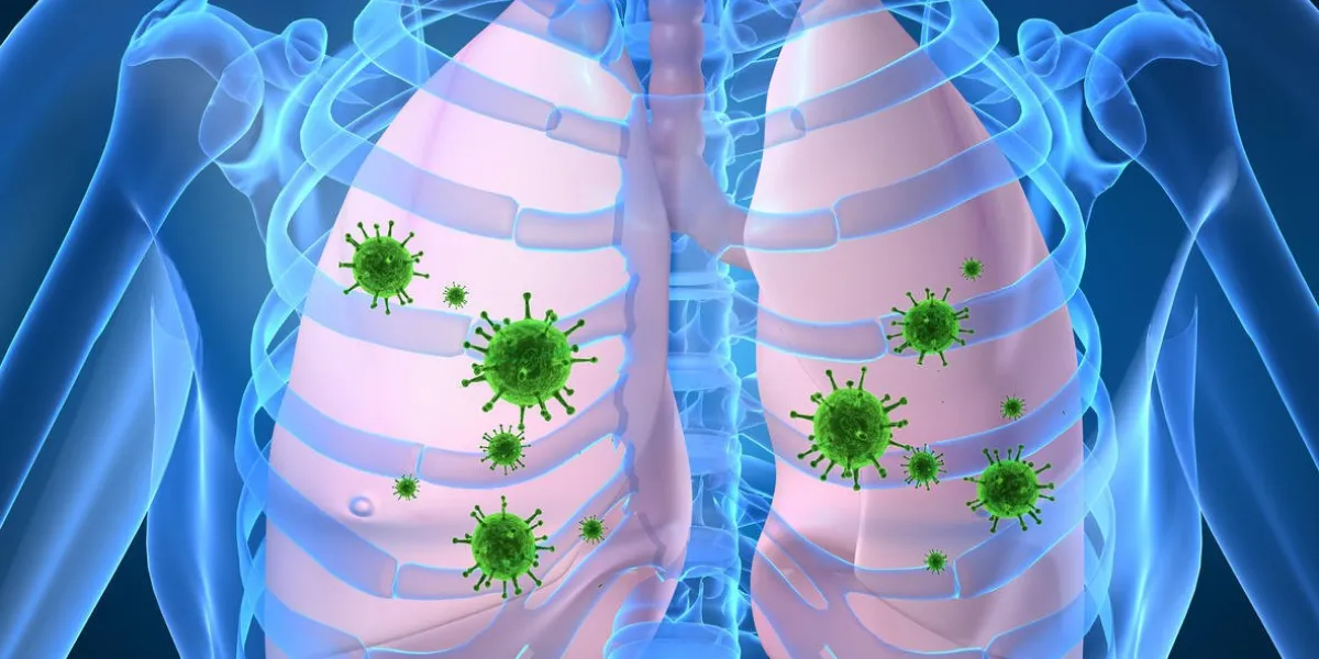 illustration 3d - infection pulmonaire