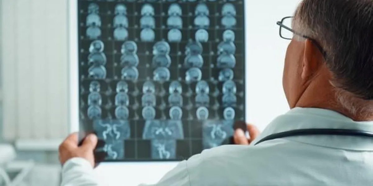 médecin homme méconnaissable examine irm image de tête humaine à l'hôpital