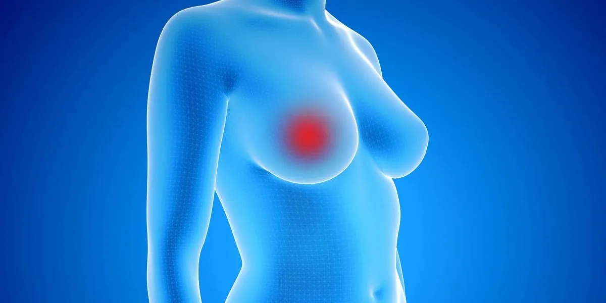 3d rendering illustration of female body with breast cancer