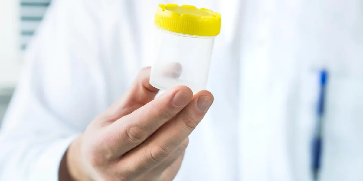 doctor holding urine sample cup medical test in hospital