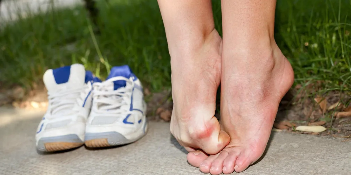 inconfort et démangeaisons causées par un champignon, douloureux pied femelle meurtri sur le sol