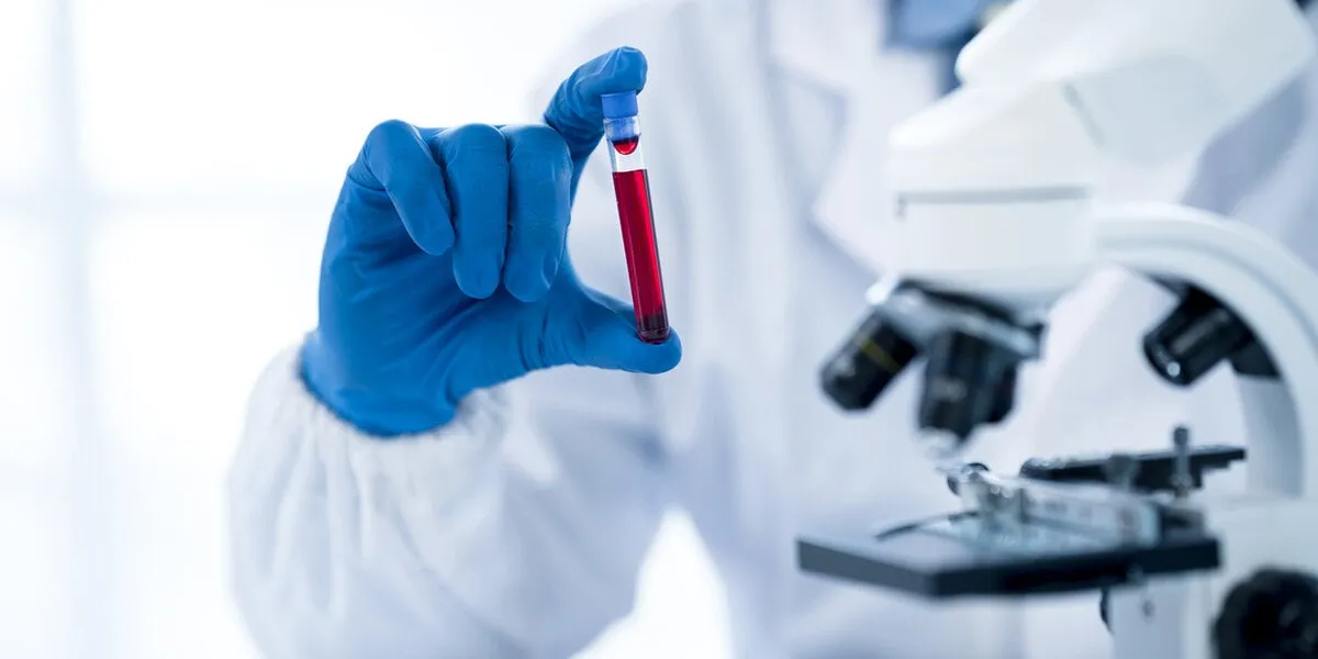 doctor hand taking a blood sample tube from a rack with machines of analysis in the lab background, technician holding blood tube test in the research laboratory